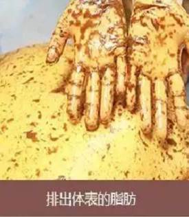 999
